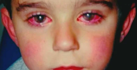 ამ ბავშვმა მხედველობის 75% დაკარგა იმ ნივთის გამო, რომელიც შეიძლება ყველას აქვს სახლში!