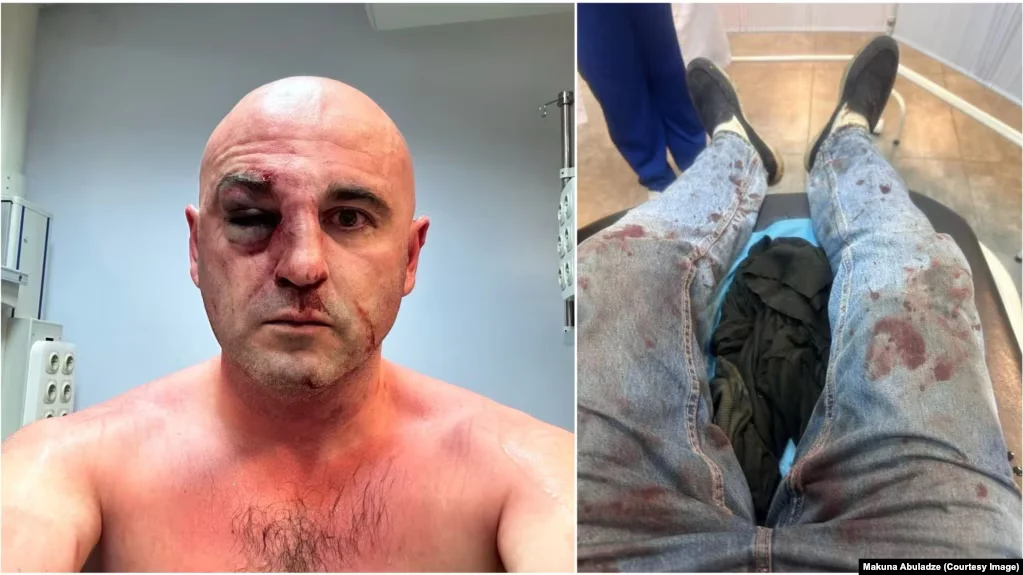 (ვიდეო) პირველი კადრები: როგორ და რატომ დააკავა და სცემა ლევან ხაბეიშვილი სპეცრაზმმა - ინტერვიუს იძლეოდა, უცებ შეწყვიტა და პირდაპირ სპეცრაზმელთა კორდონისკენ გაექანა...